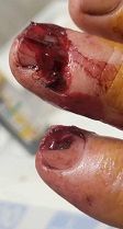 fingers-2.jpg